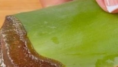 1000 Times Stronger Than Botox! Natural Collagen Aloe Vera! Erases All Wrinkles