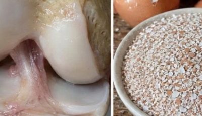 collagen, eggshells are a lifesaver. Recipe in the first comment.