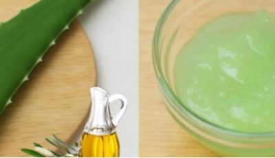 Aloe Vera for Varicose Veins and Tired Legs: Natural Relief You Can Try at Home
